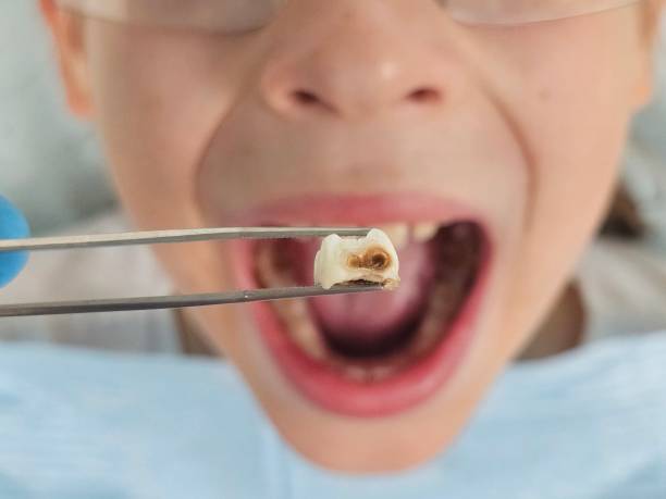 Best Emergency Gum Pain Relief  in Chesaning, MI