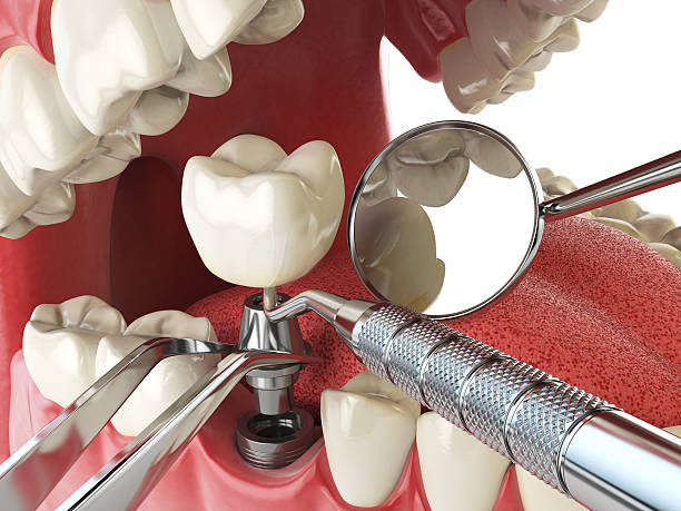 Best Emergency Gum Pain Relief  in Chesaning, MI
